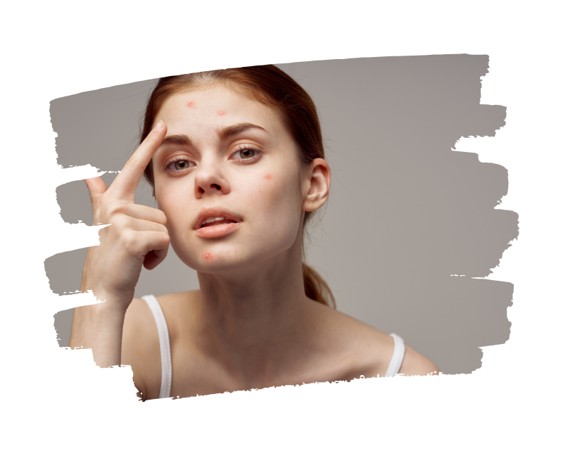 Extraire ou ne pas Extraire ? Peser les Avantages et les Risques pour la Peau